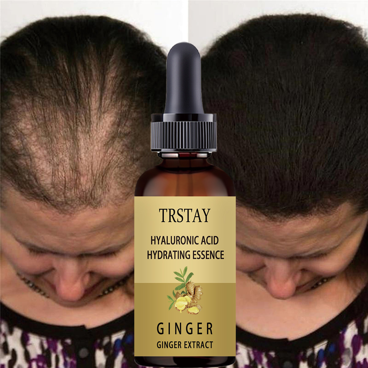 Hair Care Gisou - Haargroei Serum Anti Voorkomen Haaruitval Alopecia