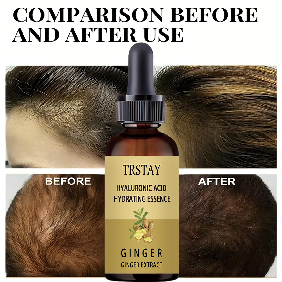 Haargroei Serum Anti Voorkomen - Hair Care Gisou recensie en prijs