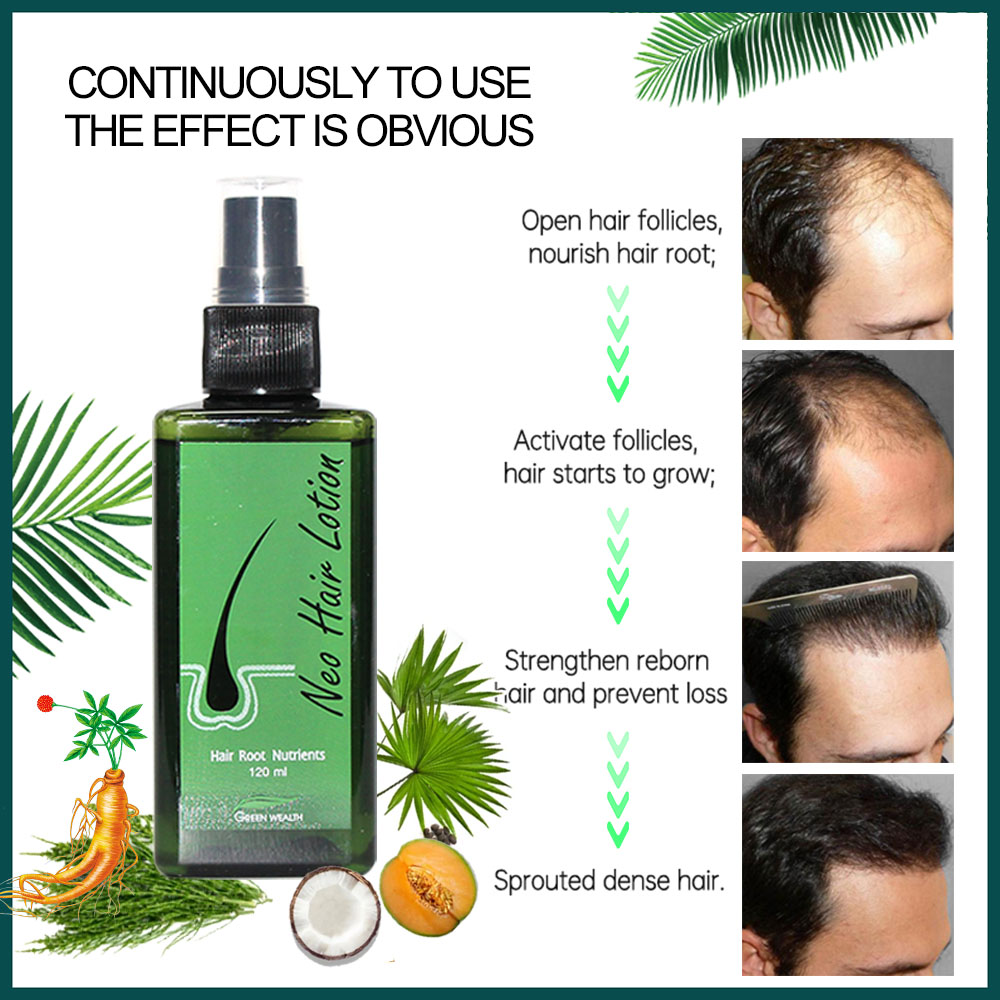 Originele Neo Haarlotion 120 m - Hair Care Gisou recensie en prijs